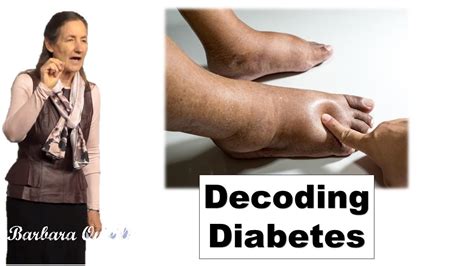 Decoding Diabetes From Sickness To Health Dr Barbara O Neill