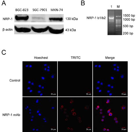 Expression And Distribution Of Nrp 1 In Human Gastric Cancer Cells A