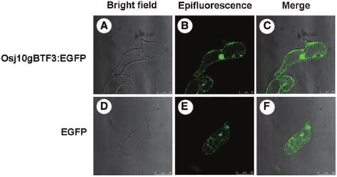 Subcellular Localization In Transfected Tobacco Suspension Cells A C