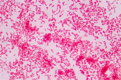 Microbial Top Facts Pseudomonas Aeruginosa