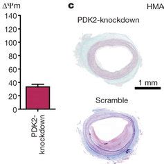 PDK2 knockdown alleviates myointima formation in vivo. a,... | Download ... 
