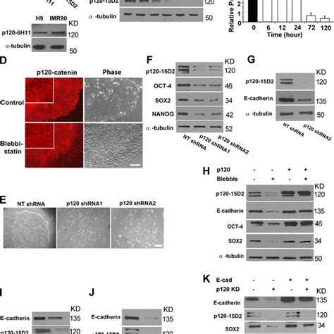 Nmmiia Modulates E Cadherin Expression Via P120 Catenin A Western Download Scientific