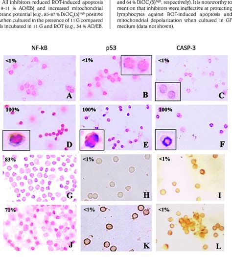 Glucose Induces Nf Kb Activation And P And Caspase Inhibition