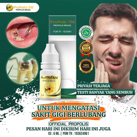 Jual Obat Sakit Gigi Berlubang Gigi Berlubang Anak Dan Dewasa Polip