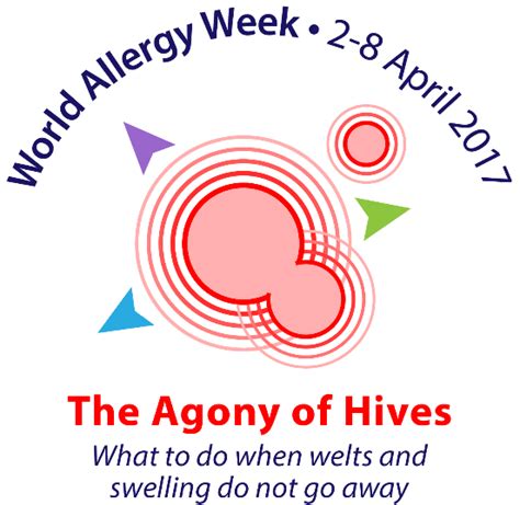 World Allergy Week Waitara Medical News