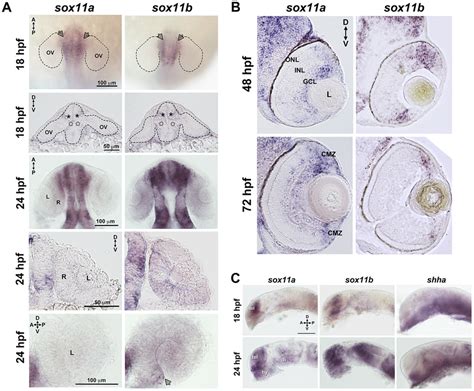 Developmental Expression Of Sox11 In Situ Hybridization With Antisense