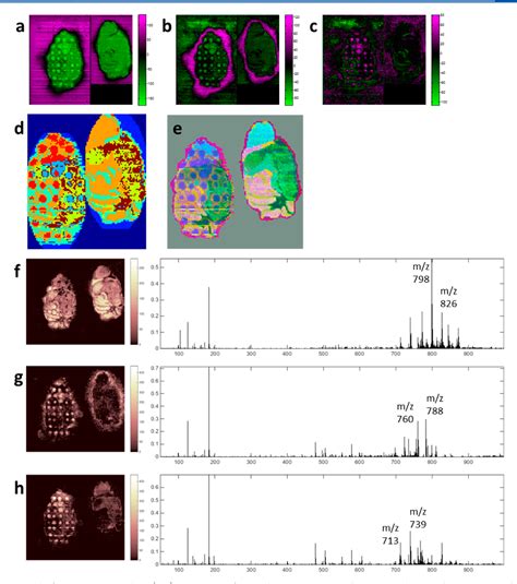 PDF MALDI Imaging Of Liquid Extraction Surface Analysis Sampled