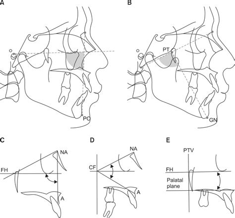 Measurements Of The Jaw To Cranium Relationship A Facial Depth B Download Scientific