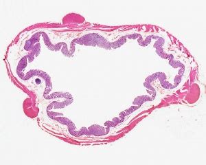 Taenia Coli Histology