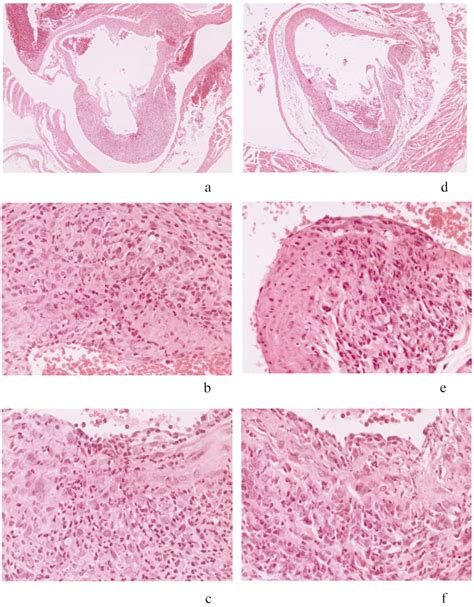 Histological Feature Of Coronary Arteritis In N1 And C3hhen A