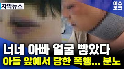 해외이슈 아들과 아들친구들이 보는 앞에서 전치 3주 폭행 당한 아빠 아빠 미안해 Youtube