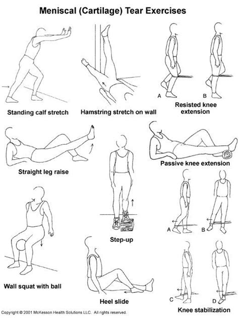 exercise for torn meniscus | ... Advisor 2003.1: Meniscal (Cartilage ...