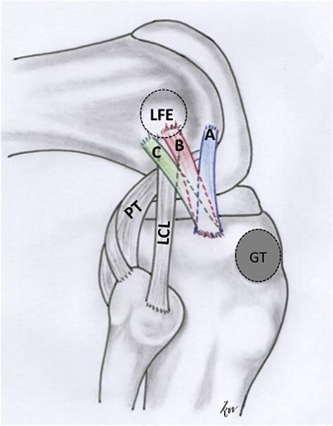 Ultrasonographic Identification Of The Anterolateral Ligament Of The