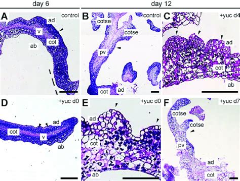 YUC-dependent auxin biosynthesis is required for the formation of ...