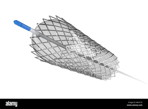 Stent Und Ballonkatheter Ausgeschnittene Stockfotos Und Bilder Alamy