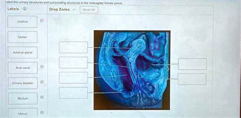 Solved Label The Urinary Structures And Surrounding Structures In The