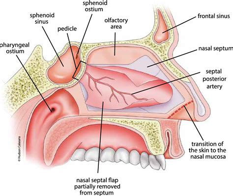 [diagram] Diagram Of Sphenoid Sinuses Mydiagram Online