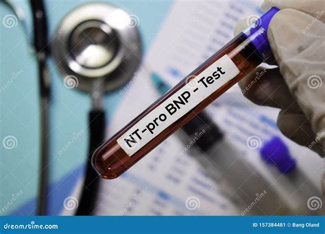 Nt Pro Bnp Test With Blood Sample Top View Isolated On Office Desk