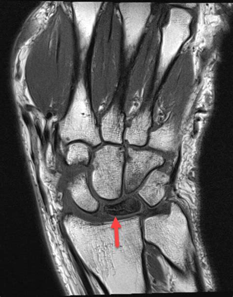 Case Added Today Klick To See Radiology For Beginners By Dr Samuel Kobba