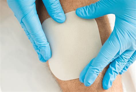 Hydrocolloid Dressing