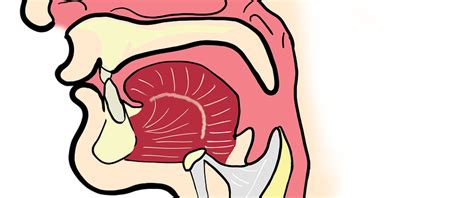 Medidas Innovadoras En La Dieta Para Personas Con Disfagia En Esclerosis Múltiple Esclerosis