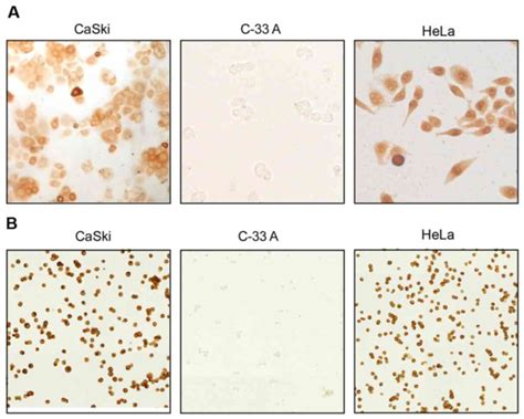 Immunohistochemical Detection Of E Human Papillomavirus Protein In Pre