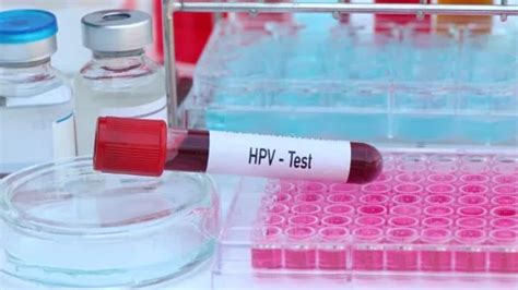 HPV Test To Look For Abnormalities From Stock Video Pond5