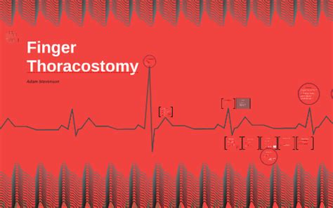 Finger Thoracostomy by Adam Stevenson on Prezi