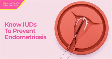 Iuds And Endometriosis All You Need To Know Her Smart Choice