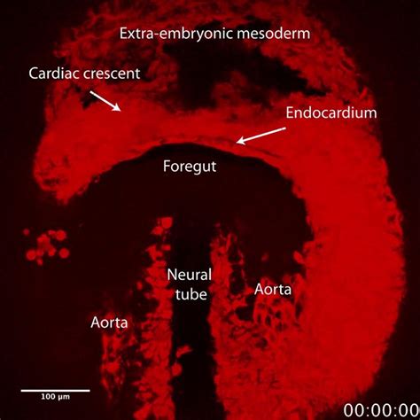 Live Imaging Of Heart Tube Development In Mouse Reveals Alternating