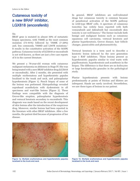 Pdf Cutaneous Toxicity Of A New Braf Inhibitor Lgx Encorafenib