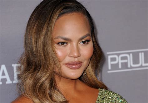 Chrissy Teigen Revealed She Had Buccal Fat Removal Realself News