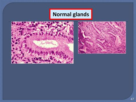 Ppt Neoplasia Powerpoint Presentation Free Download Id 6161338