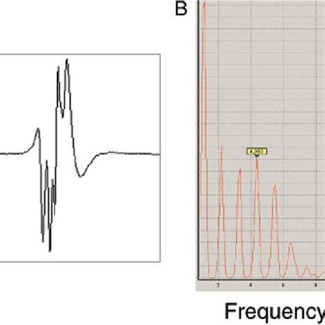 Pre Ablation Fractionated Electrogram A Endocardial Electrogam From