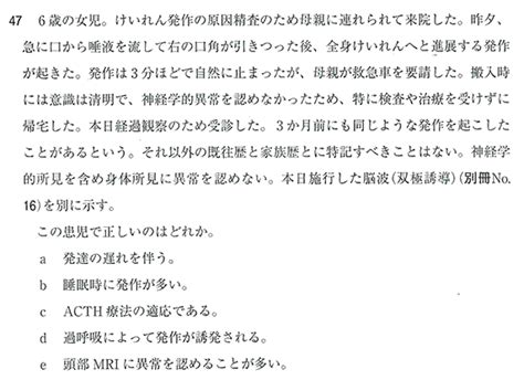 Osalepsy＠小児科・てんかん専門医 On Twitter 中心側頭部に棘波を示す小児てんかんcects Rolandてんかんとも