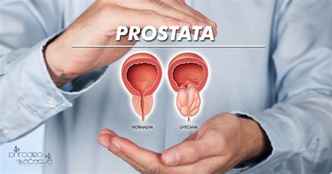 Uve Ana Prostata Le Enje Simptomi I Dijagnoza Prirodno Le Enje