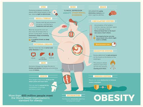 What Is Obesity Overview Of Obesity Blue Guys News