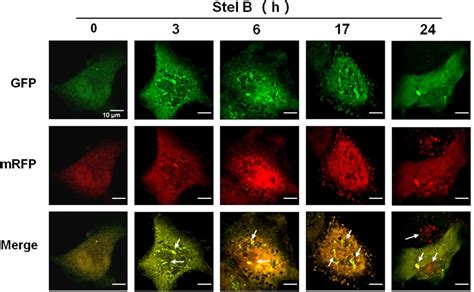 Stel B Promoted Autophagic Flux In A549 Cells A549 Cells Were