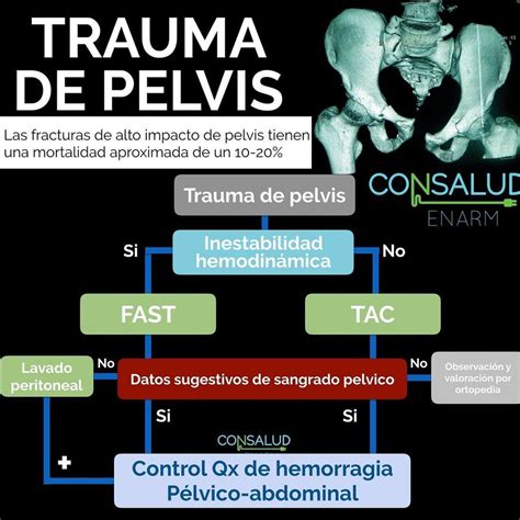 Consalud Enarm En Instagram Hablemos De Apendicitis Consaludenarm