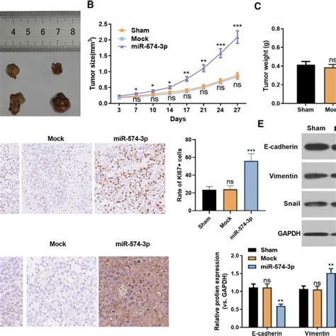 Mir P Promoted Gc Migration Invasion And Emt In Vitro Mir P