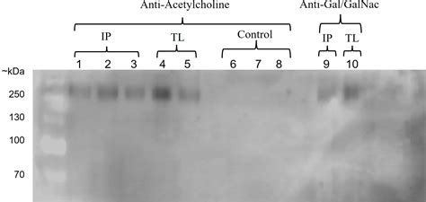 Frontiers The Gal GalNac Lectin As A Possible Acetylcholine Receptor