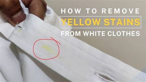 How To Remove Yellow Stains Or Turmeric Stain From White Clothes YouTube