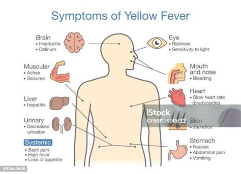 Diagramme Des Symptômes Du Patient De La Fièvre Jaune Vecteurs Libres