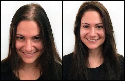 Before And After Wigs And Toppers Jessica Hyllarée