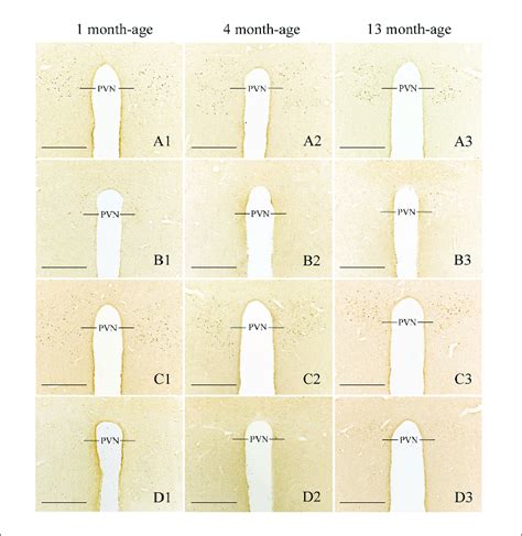 Representative Photomicrographs Showing Fos Immunolabeling In The Pvn Download Scientific