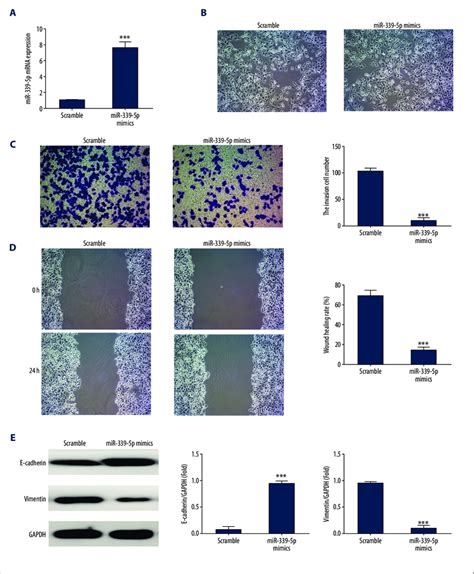 Mir P Overexpression Affected Panc H Cell Invasion And