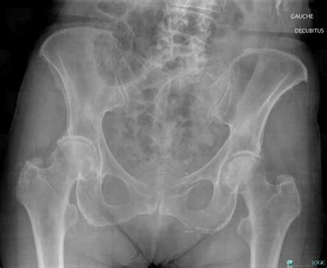 Radiology Case Fracture X Rays Diagnologic