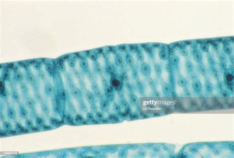 Spirogyra Green Alga Vegetative Cell Shows Nucleus Spiral Chloroplast