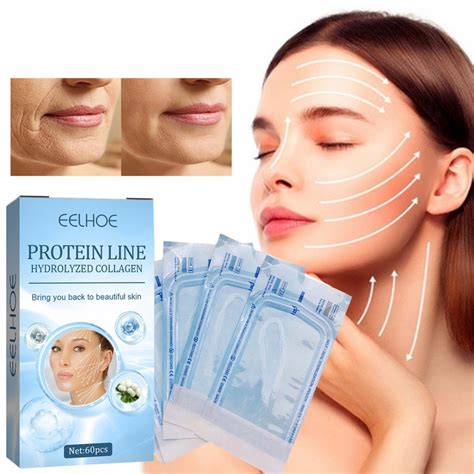 5bags60pcs Protein Face Lifting Thread Absorbable Gold Protein Line
