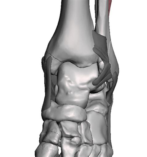 Weber B Fracture Surgistud